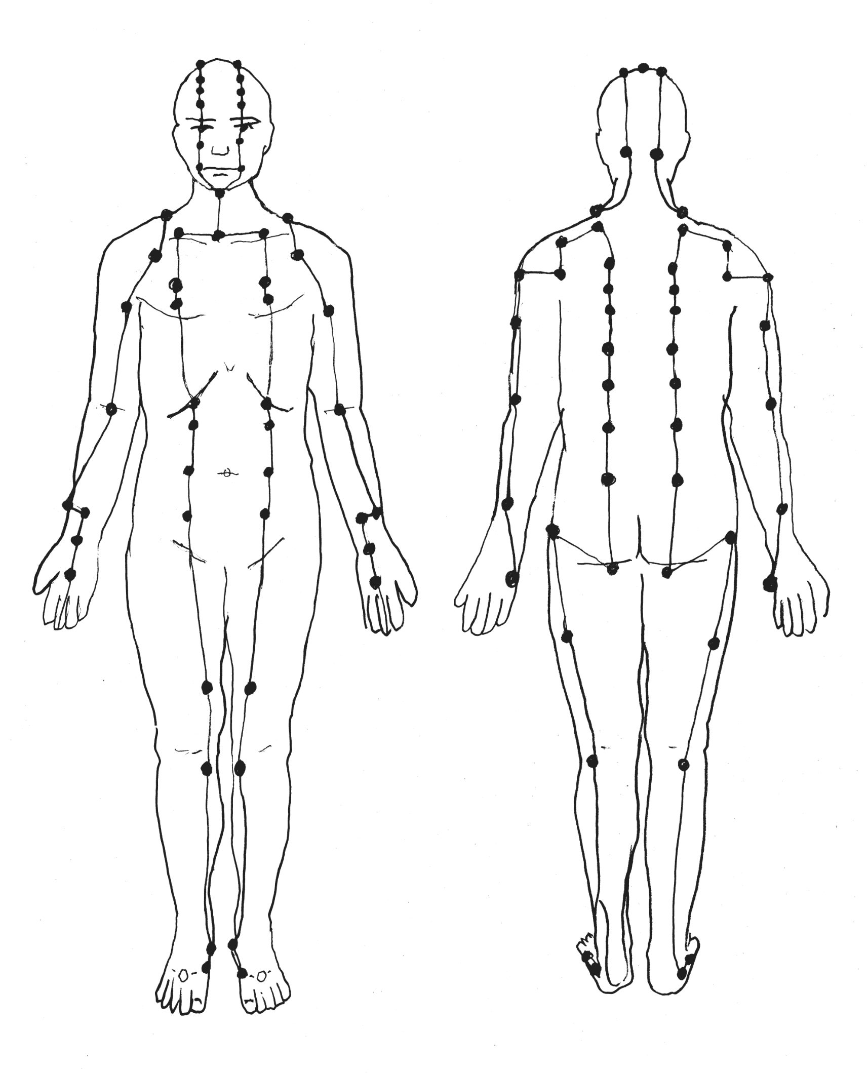 Minh họa các huyệt: LU 7, PC 3, PC 2, LU 1, GB 21, GB 20, GB 17