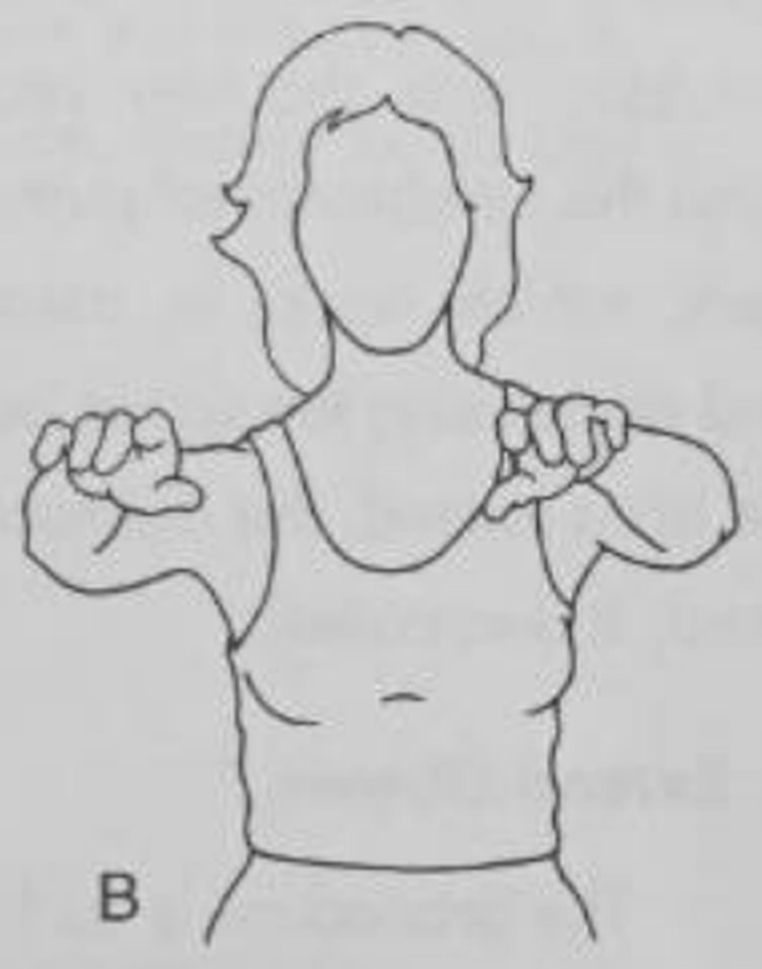 figure 10-6b