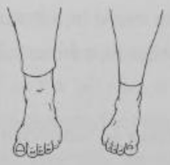 figure 12-15a
