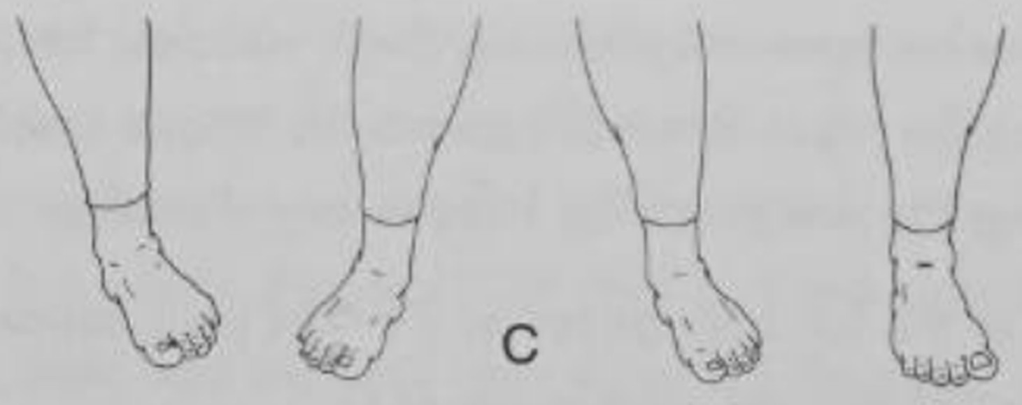 figure 12-15b