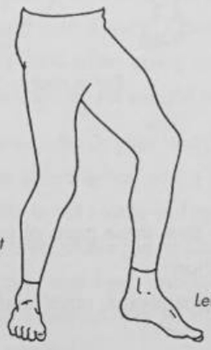 figure 12-2
