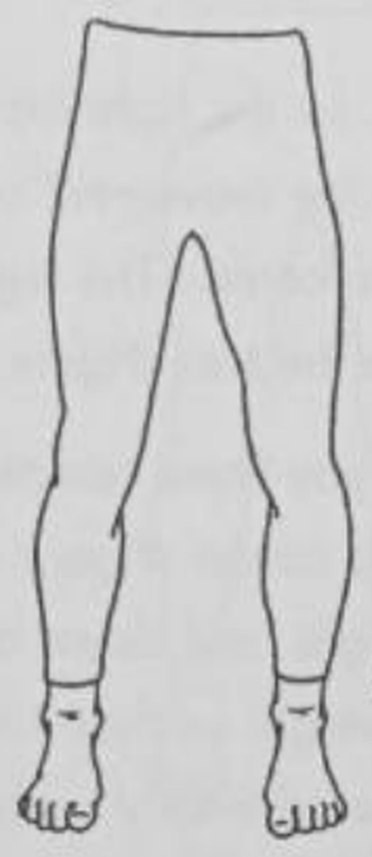 figure 12-5