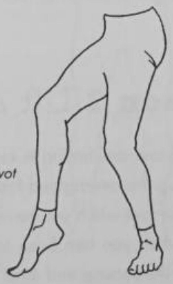 figure 12-6