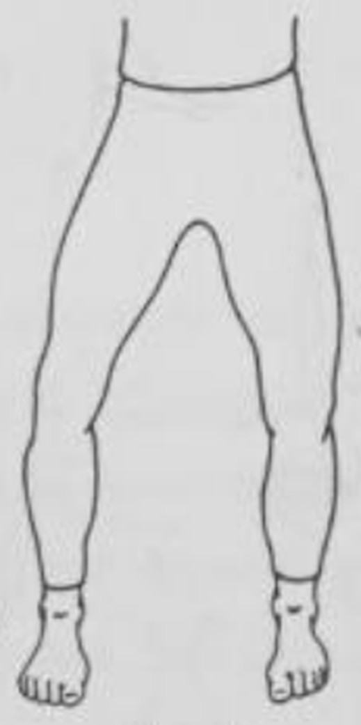 figure 13-2
