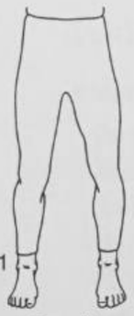 figure 13-3