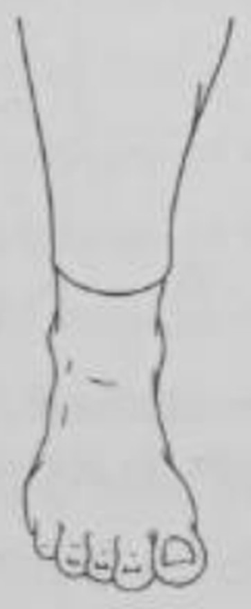 figure 6-2