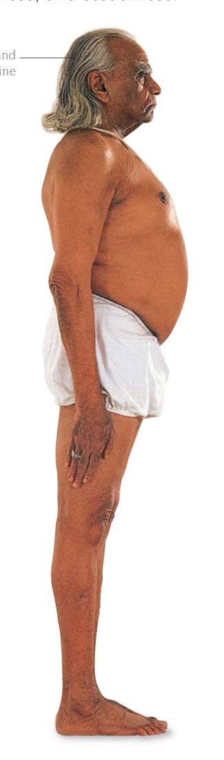 Paschimottanasana