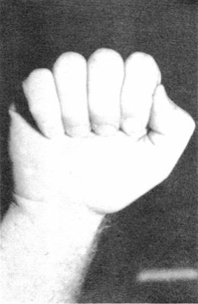 Tiến Bước, Gạt, và Đấm (Step Forward, Parry, and Punch) — hình 39, ảnh gốc trang 36