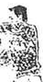 fig717-38